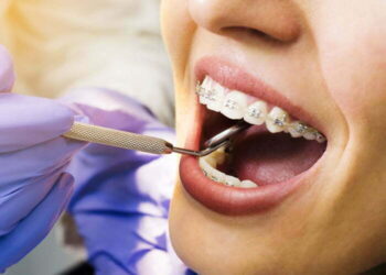 orthodontic_home_services