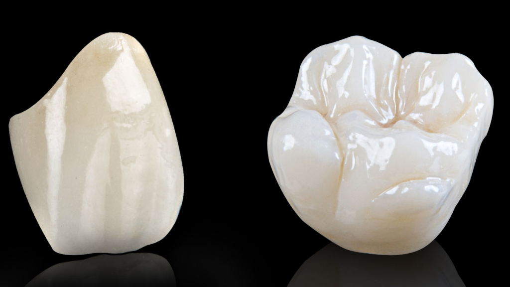 dental tourism